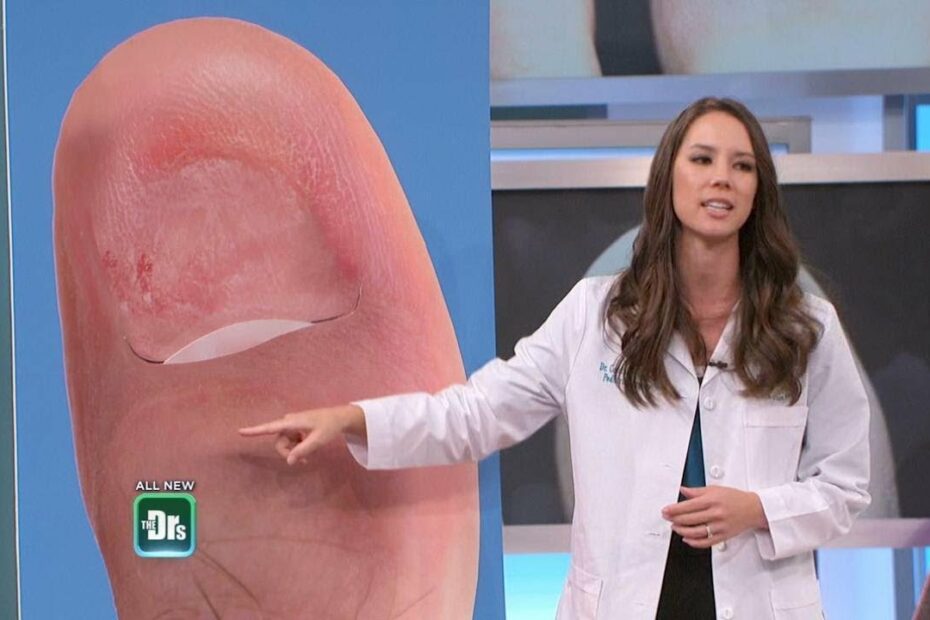 How Long Can Toe Fungus Live In Shoes