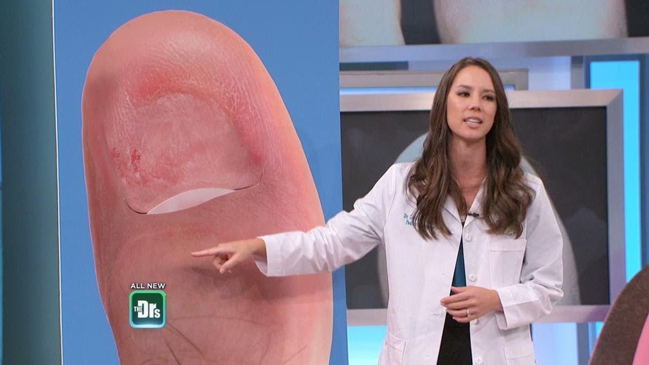 How Long Can Toe Fungus Live In Shoes