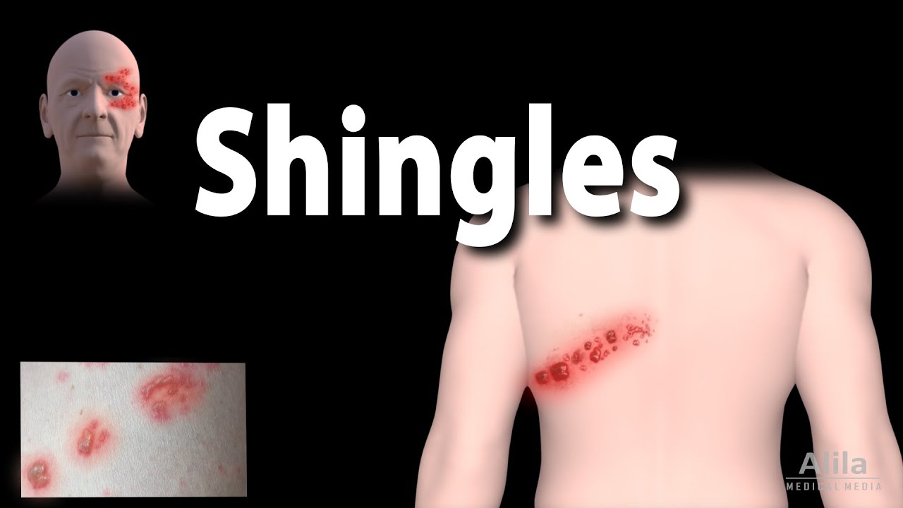 How Big Is A Shingle