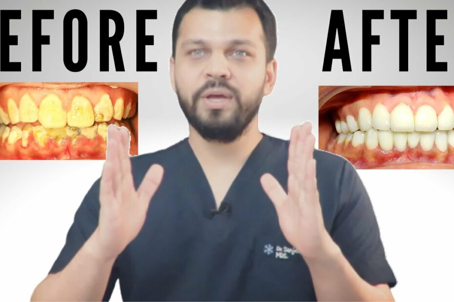 How Much Does Smile Correction Cost