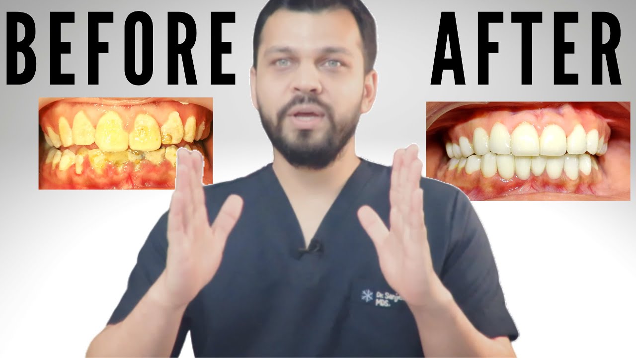 How Much Does Smile Correction Cost