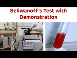 Organic Chemistry - What Is The Mechanism Of Salkowski Reaction Of  Сholesterols? - Chemistry Stack Exchange