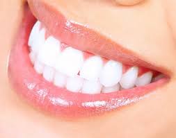 Zingers And Teeth Whitening | Profilo Dental